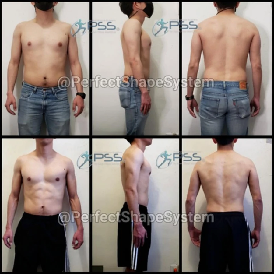 Resultados PSS - Auditoría Postural y Recomposición en 3 Ángulos