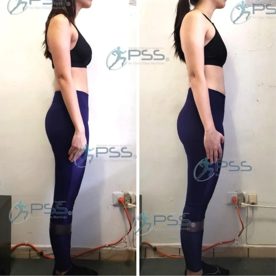 Testimonio Glute Max - Proyección Lateral y Firmeza