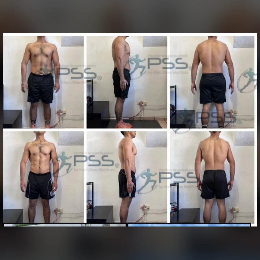 Resultados PSS - Transformación Integral Frente, Perfil y Espalda