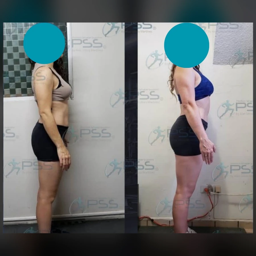 Testimonio Glute Max - Curvatura y Perfil Estético
