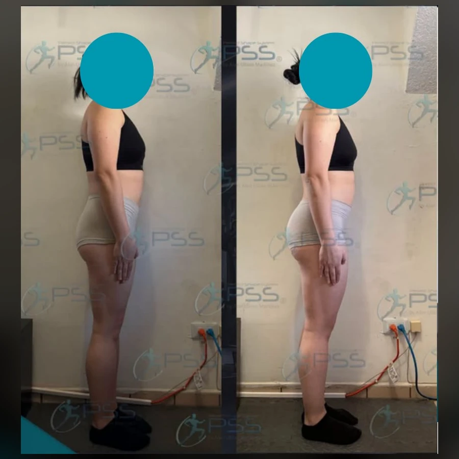 Testimonio Glute Max - Proyección Glútea y Firmeza Muscular
